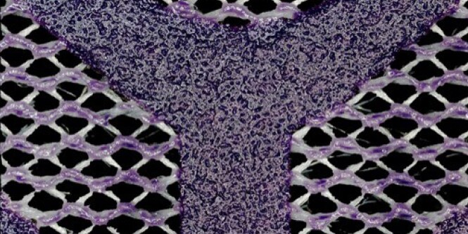 Cubitron™ II Net Abrasive
